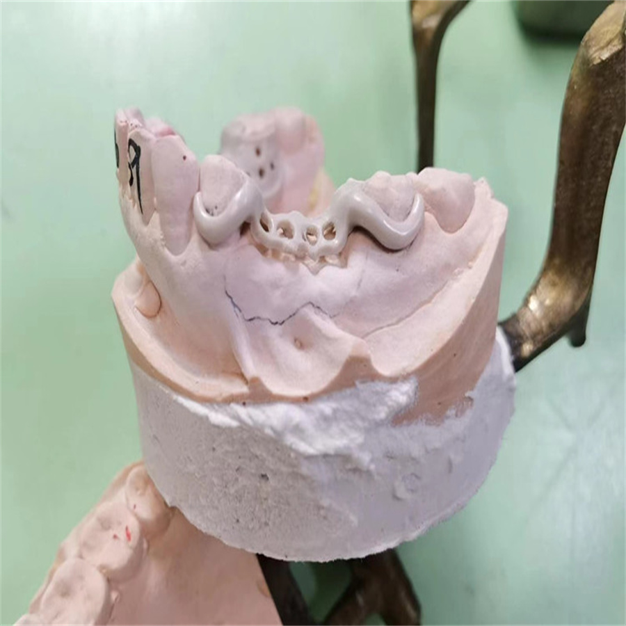 Why PEEK Is Gaining Popularity in Digital Dentistry(图4)