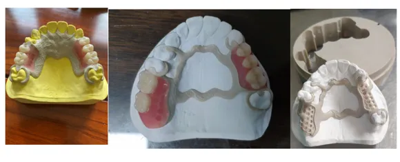 Partial PEEK disc(图1) Partial PEEK disc(图1)