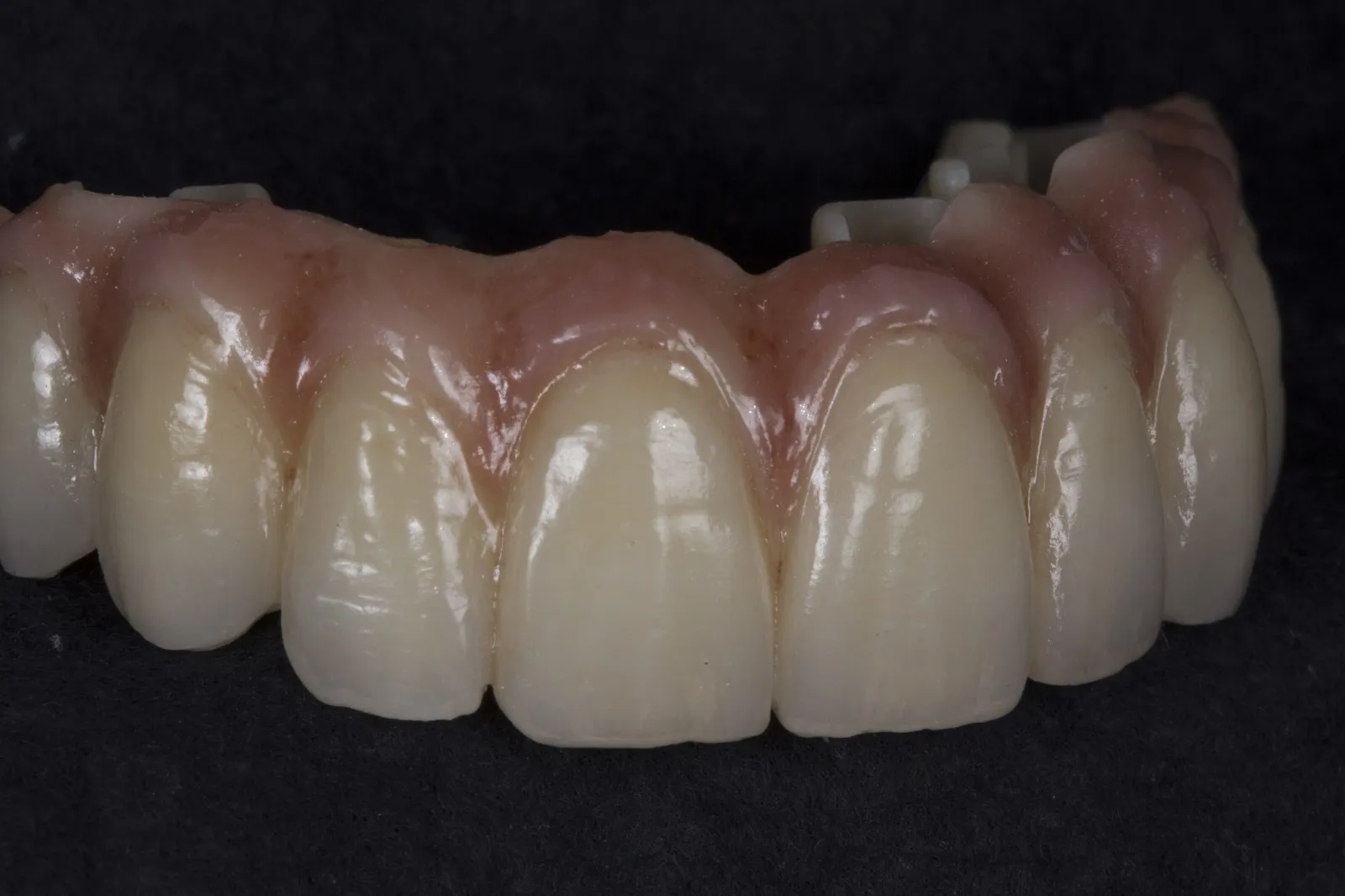 People like anterior restoration zirconia blocks for several reasons:(图2)