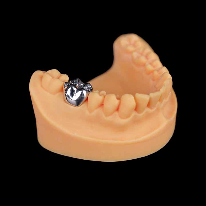 From $100 to $1000, From Resin to Ceramic: How to Choose the Right Dental Crown