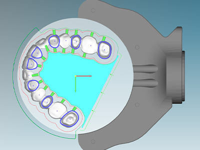 Why Zirconia Restorations Break Before Sintering — Practical Tips to Avoid It
