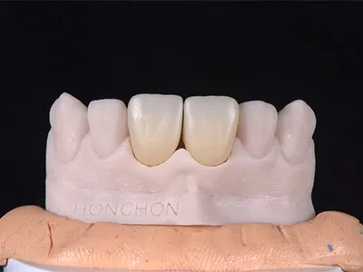 Premium Dental Zirconia Blocks – Strong, Aesthetic CAD/CAM Restorations