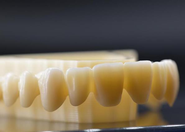 Mastering Zirconia Cut Back: A Step-By-Step Guide