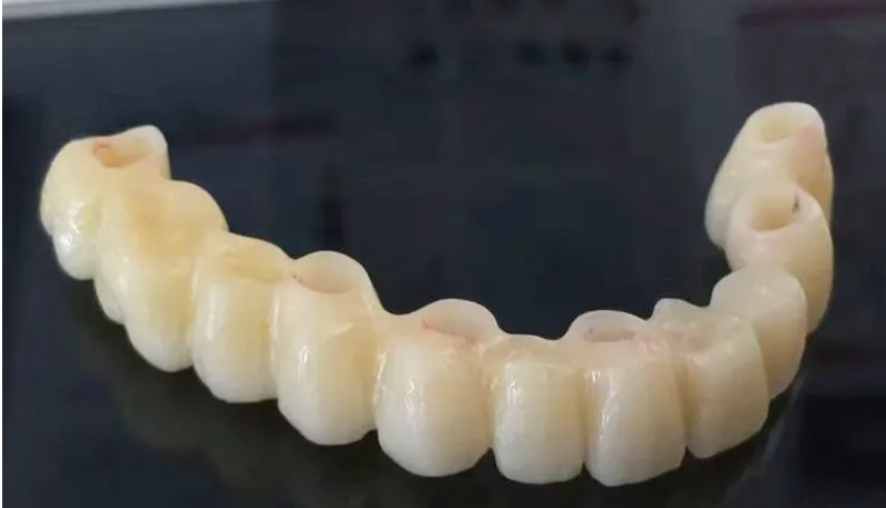 Dental PMMA Blocks: Being Developed and Used