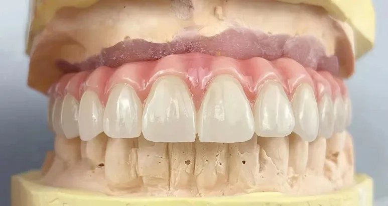 Problems, Causes and Solutions of Full Denture Fabrication