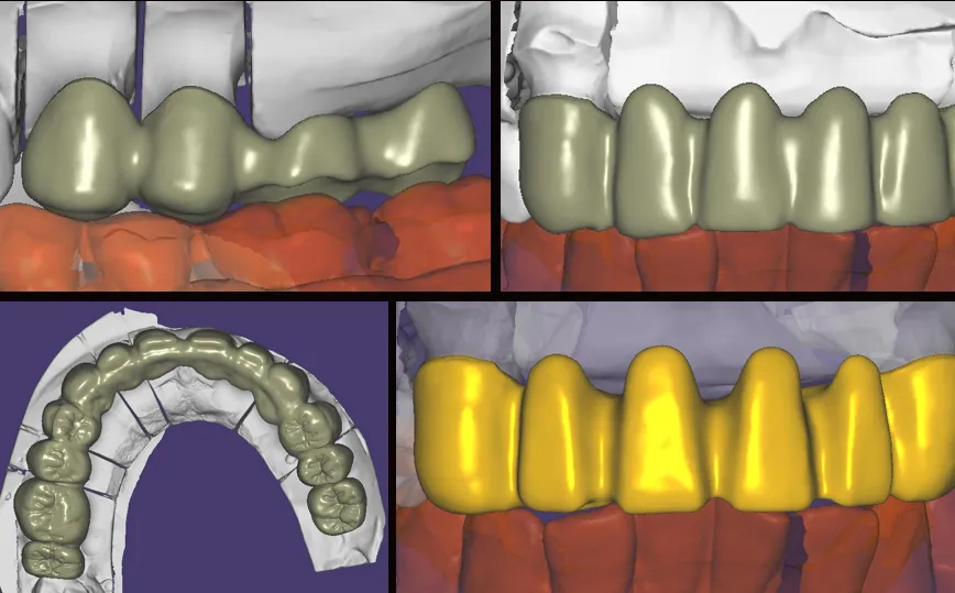 Production and Characterization of Dental Zirconia Blocks(图3)