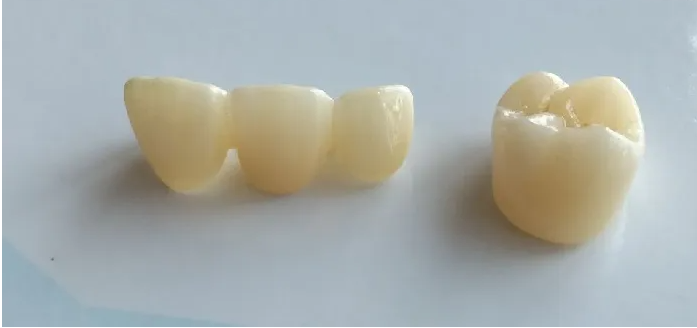 Most Common Concerns about Zirconia Porcelain Teeth(图1)