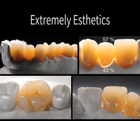 Why Is Zirconia Crown More and More Popular?(图2)