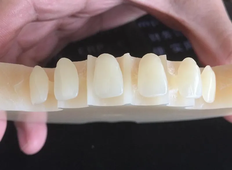 Why Pmma Materials Are Used in Dentistry