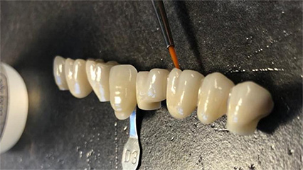 Analysis of factors affecting the color of full zirconium teeth