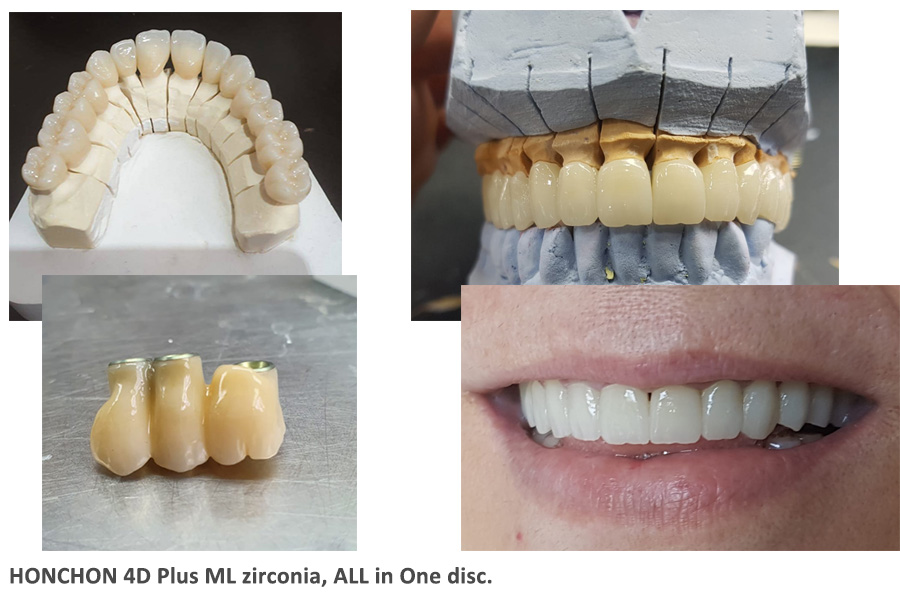 How to quickly learn about our dental zirconia blocks(图5)