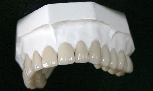 Learn more about dental zirconia
