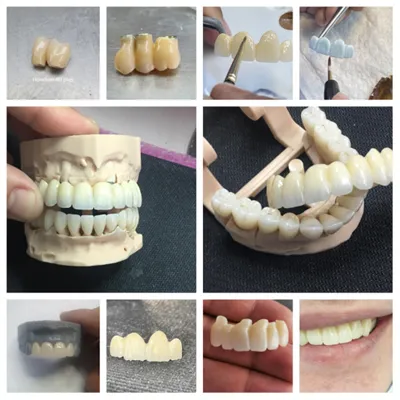 Multilayer Zirconia: 1200MPA 4D PLUS Dental Zirconia Blocks(图5)