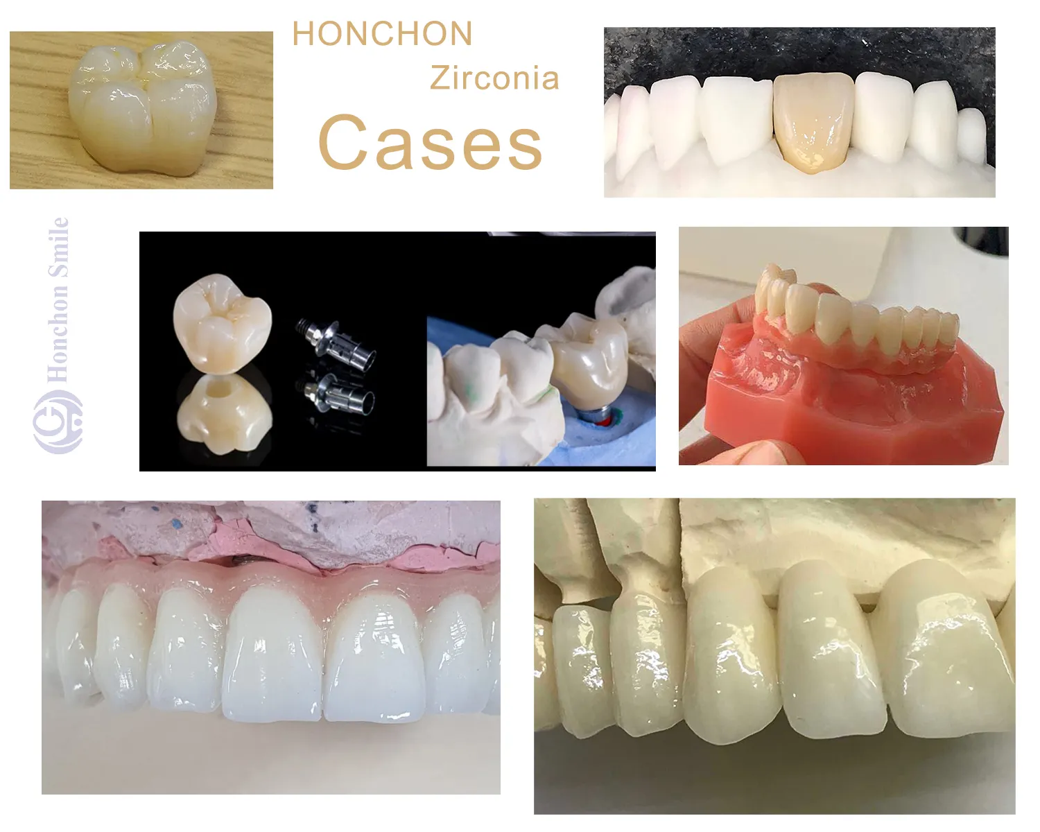 HT zirconia(图4)