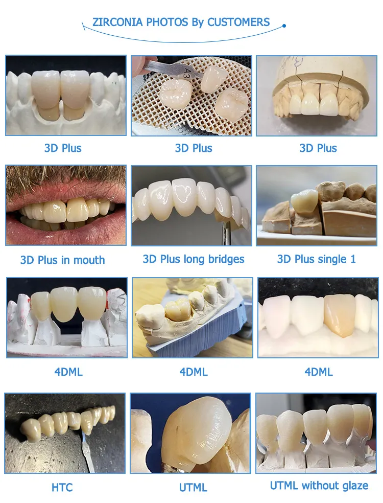 UT Multilayer Zirconia Blocks: Reliable Manufacturer in China.(图4)