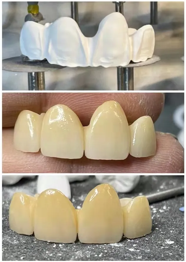 4D PLUS Multilayer Zirconia Blocks (图2)