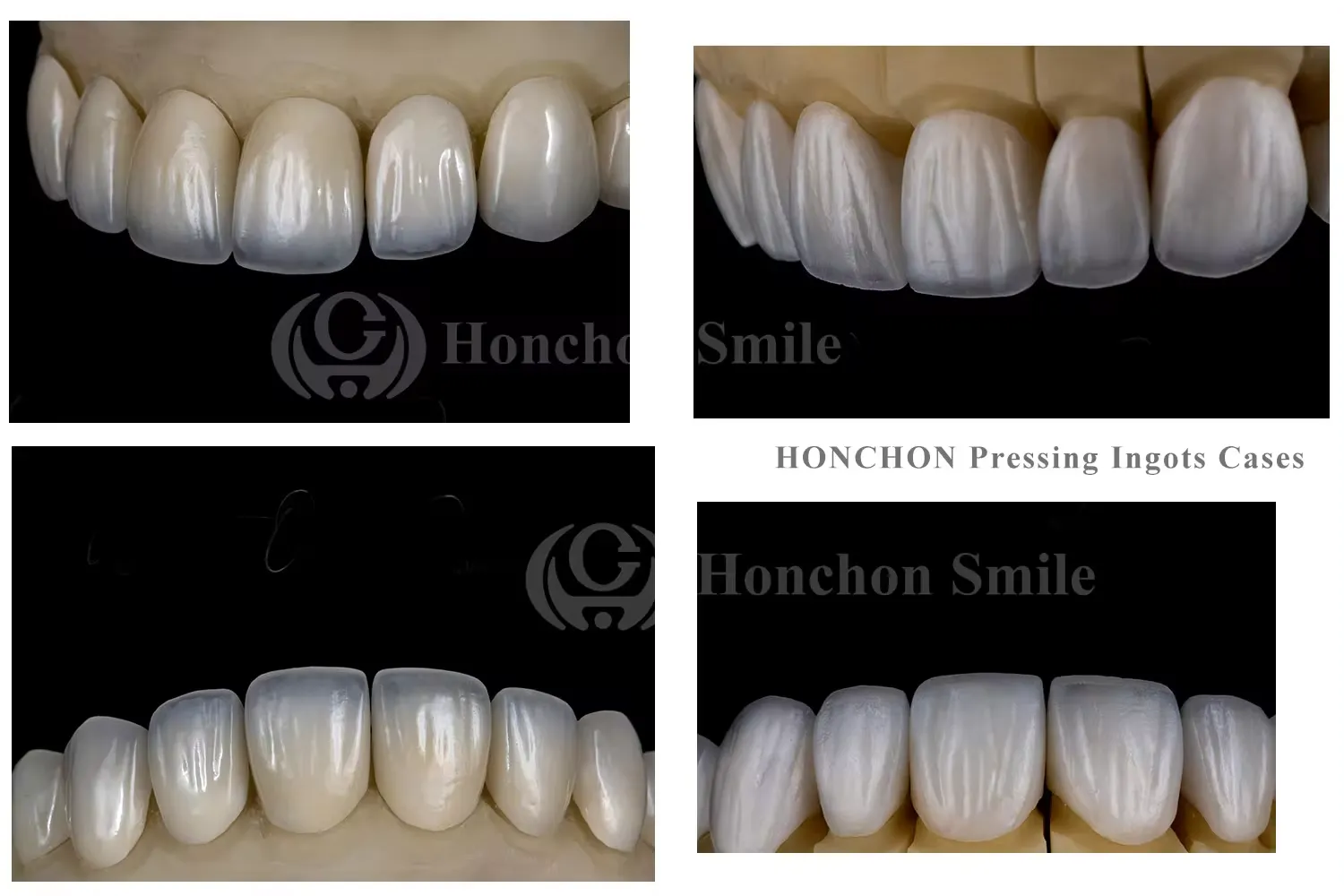 Dental lithium disilicate glass ceramics: a complete analysis of properties and applications