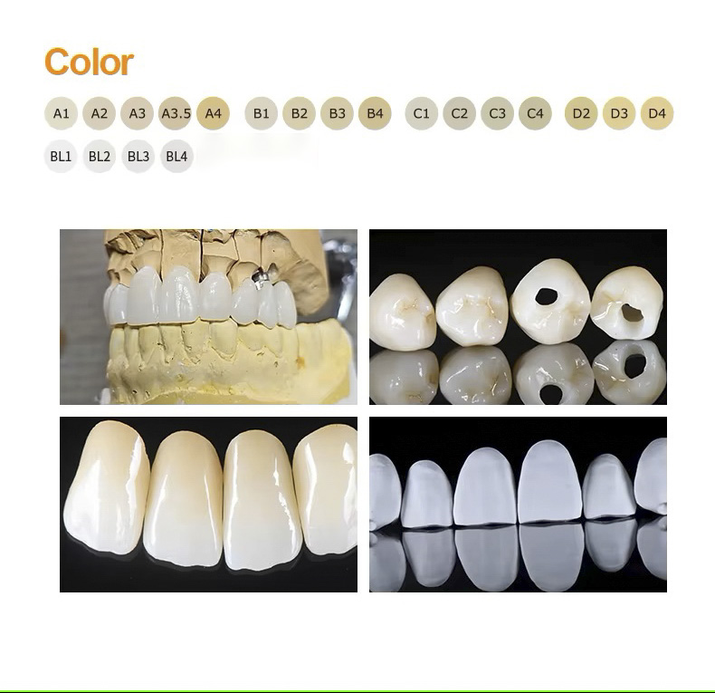 Ultra Strength Multilayer Blocks(图4)