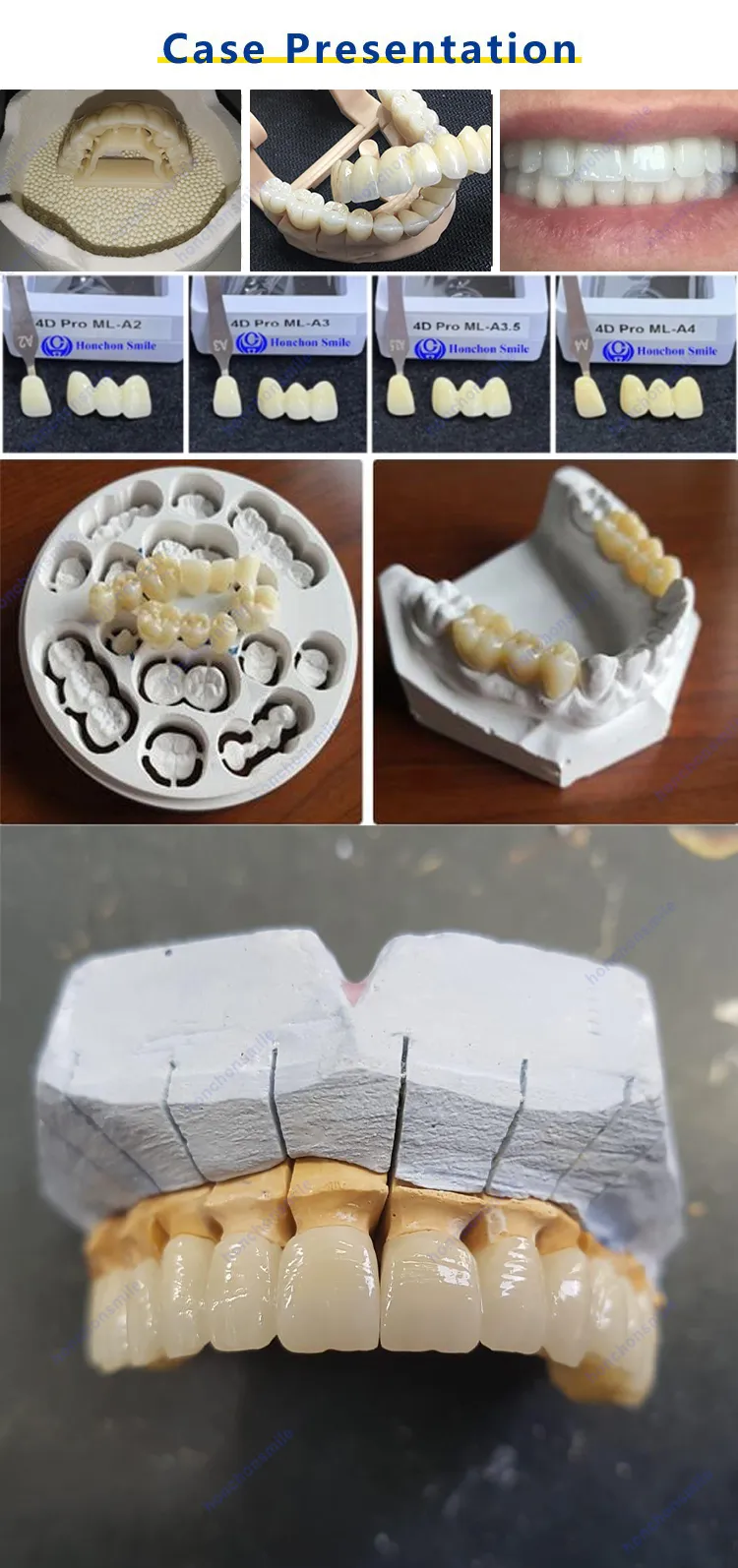  Ceramic Dental Zirconia Blocks (图6)