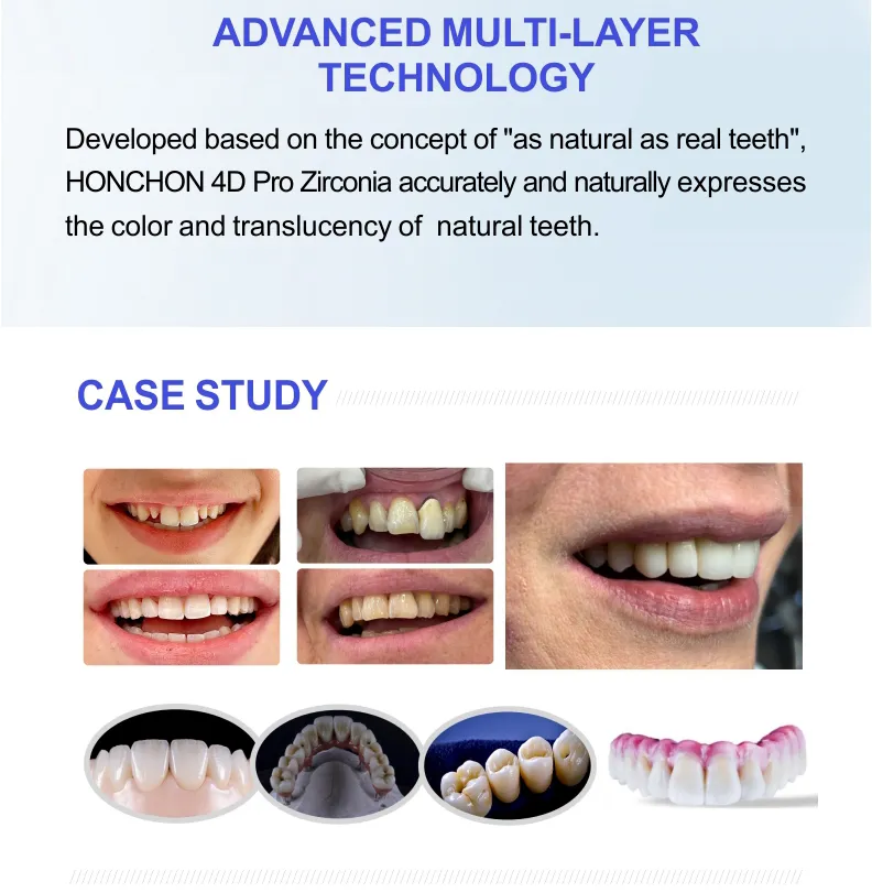 Ceramic Zirconia Blocks(图5)