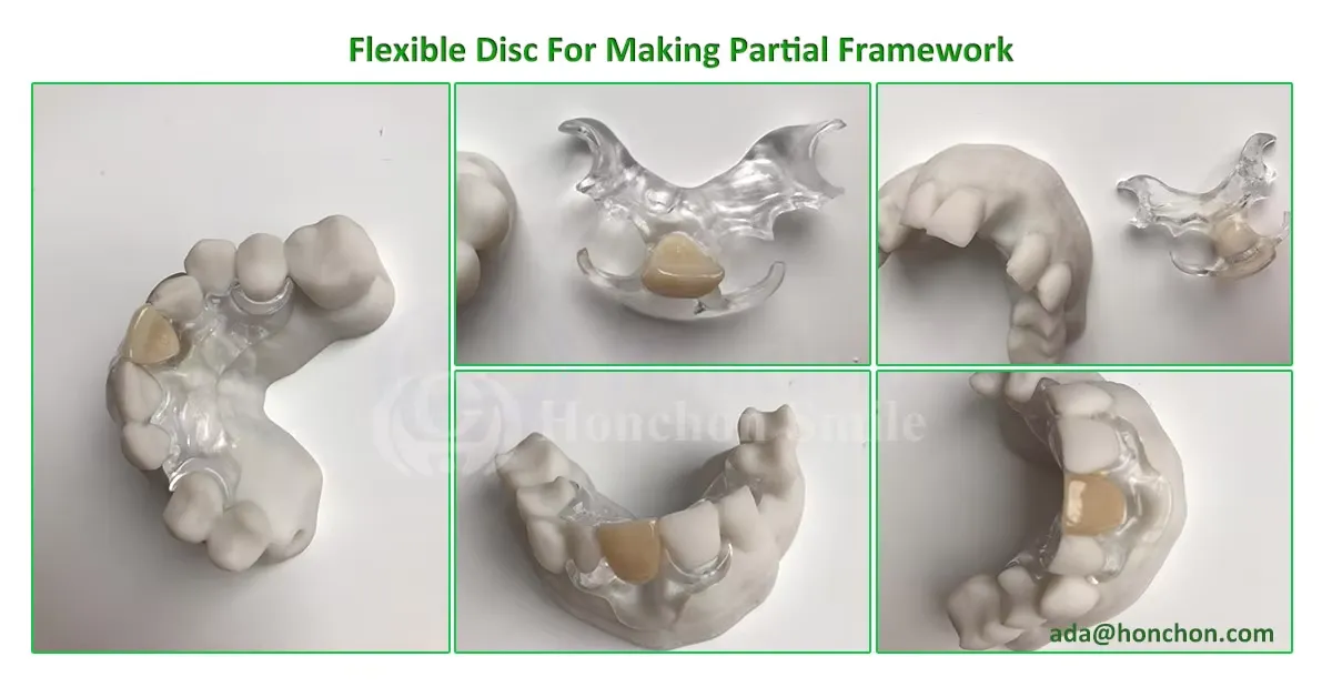  Flexible Acetal Disc(图1)