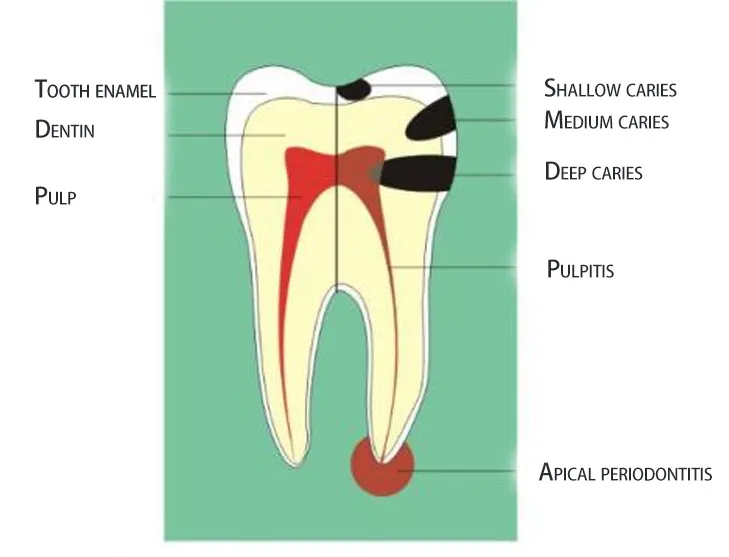 basic knowledge and common sense of the oral industry(图3)