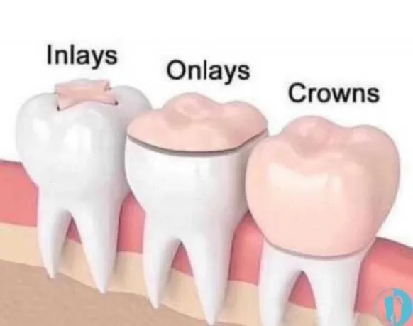 basic knowledge and common sense of the oral industry(图4)